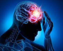 Qué es La Epilepsia